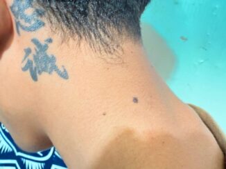 Arrestan a adolescente se le investiga por lesionar a dos personas con arma de fuego