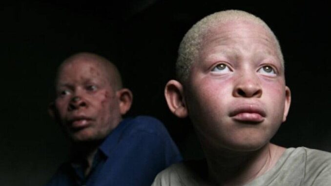 ¿qué es y por qué ocurre?