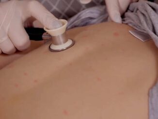 Situación del sarampión en México no está controlada, casos siguen en aumento: diputado Éctor Jaime Ramírez