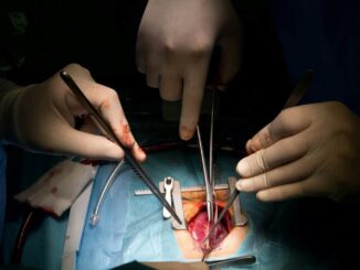 Pacientes trasplantadas piden combatir tabúes que frenan la donación de órganos en México